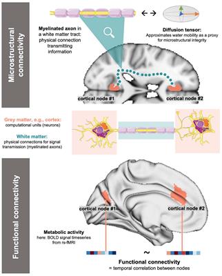 Autism spectrum disorder-specific changes in white matter connectome edge density based on functionally defined nodes